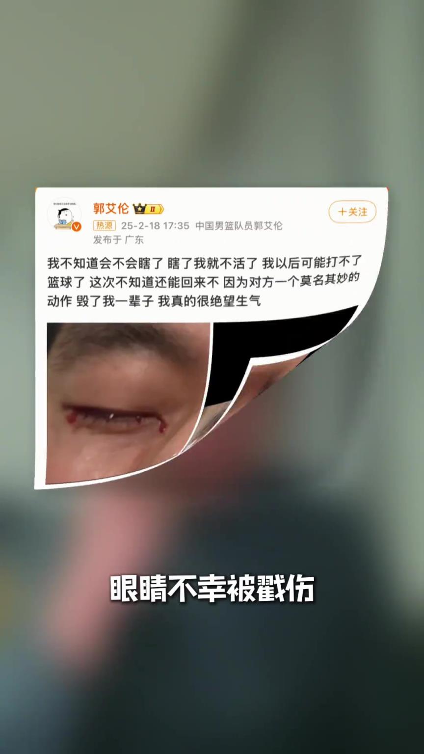 專業醫生談郭艾倫眼傷：大家不要太擔心，大概率可以恢復的